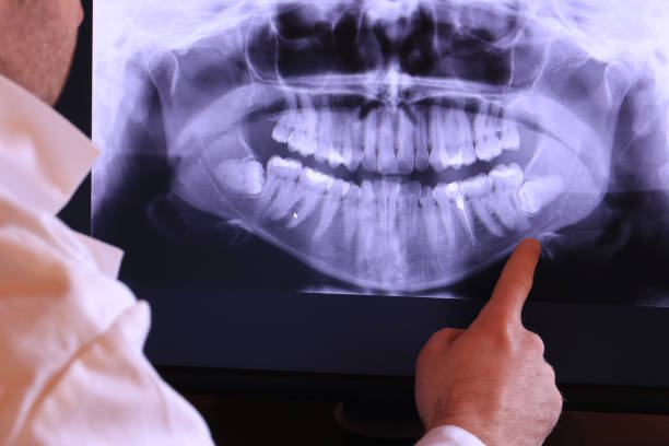 Best Root Canal Emergency Dentist  in Harvard, IL